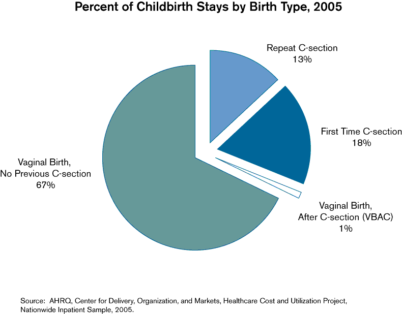Chart showing Percent of Childbirth Stays by Birth Type 2005