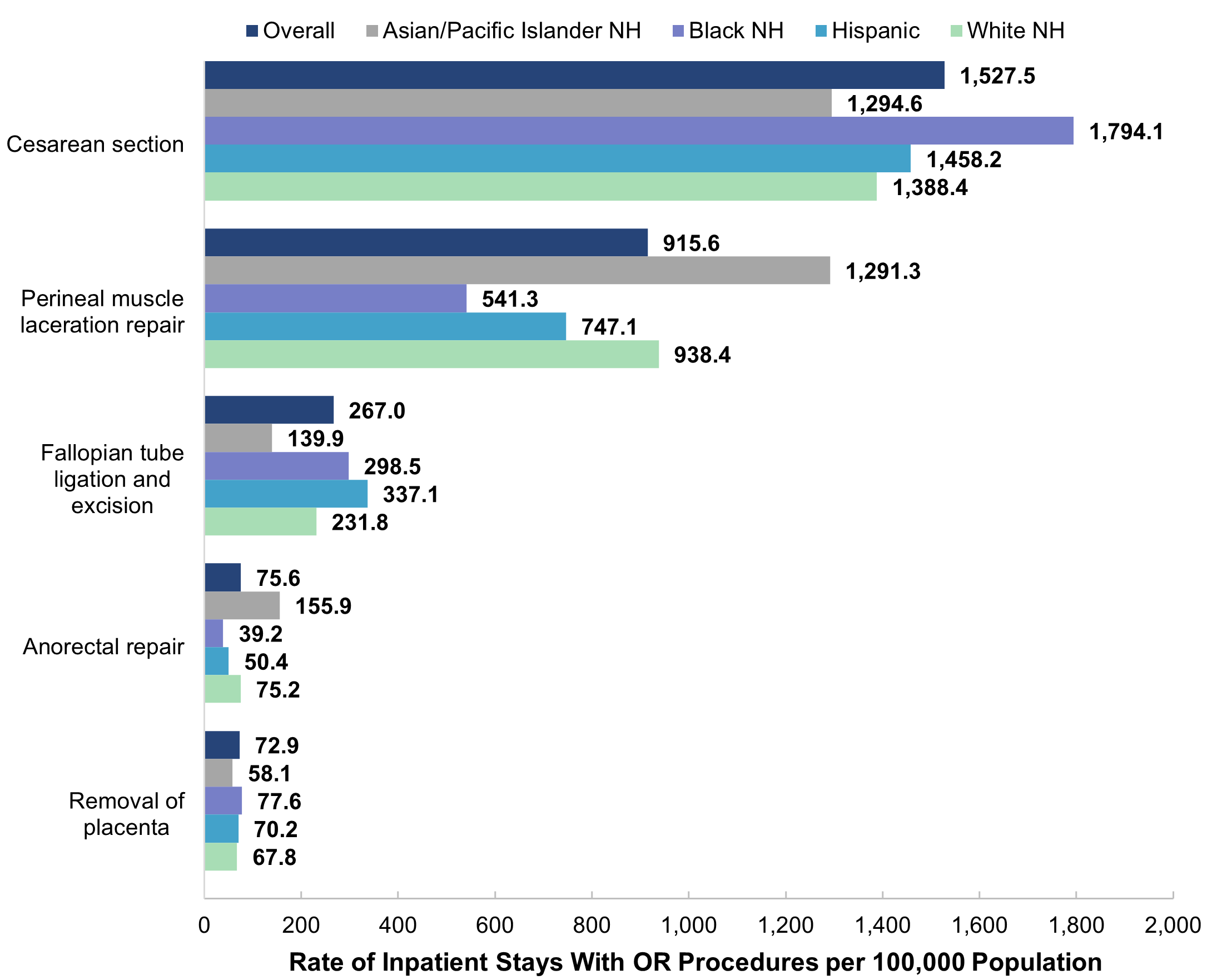 Bar chart showing the rate per 100,000 population of maternal stays with the five most common 
					operating room (OR) procedures by patient race and ethnicity (Asian/Pacific Islander [API] non-Hispanic 
					[NH], Black NH, Hispanic, White NH) in 2019. Cesarean section: overall (1,527.5), API NH (1,294.6), 
					Black NH (1,794.1), Hispanic (1,458.2), White NH (1,388.4). Perineal muscle laceration repair: overall 
					(915.6), API NH (1,291.3), Black NH (541.3), Hispanic (747.1), White NH (938.4). Fallopian tube ligation 
					and excision: overall (267.0), API NH (139.9), Black NH (298.5), Hispanic (337.1), White NH (231.8). 
					Anorectal repair: overall (75.6), API NH (155.9), Black NH (39.2), Hispanic (50.4), White NH (75.2). 
					Removal of placenta: overall (72.9), API NH (58.1), Black NH (77.6), Hispanic (70.2), White NH (67.8).
