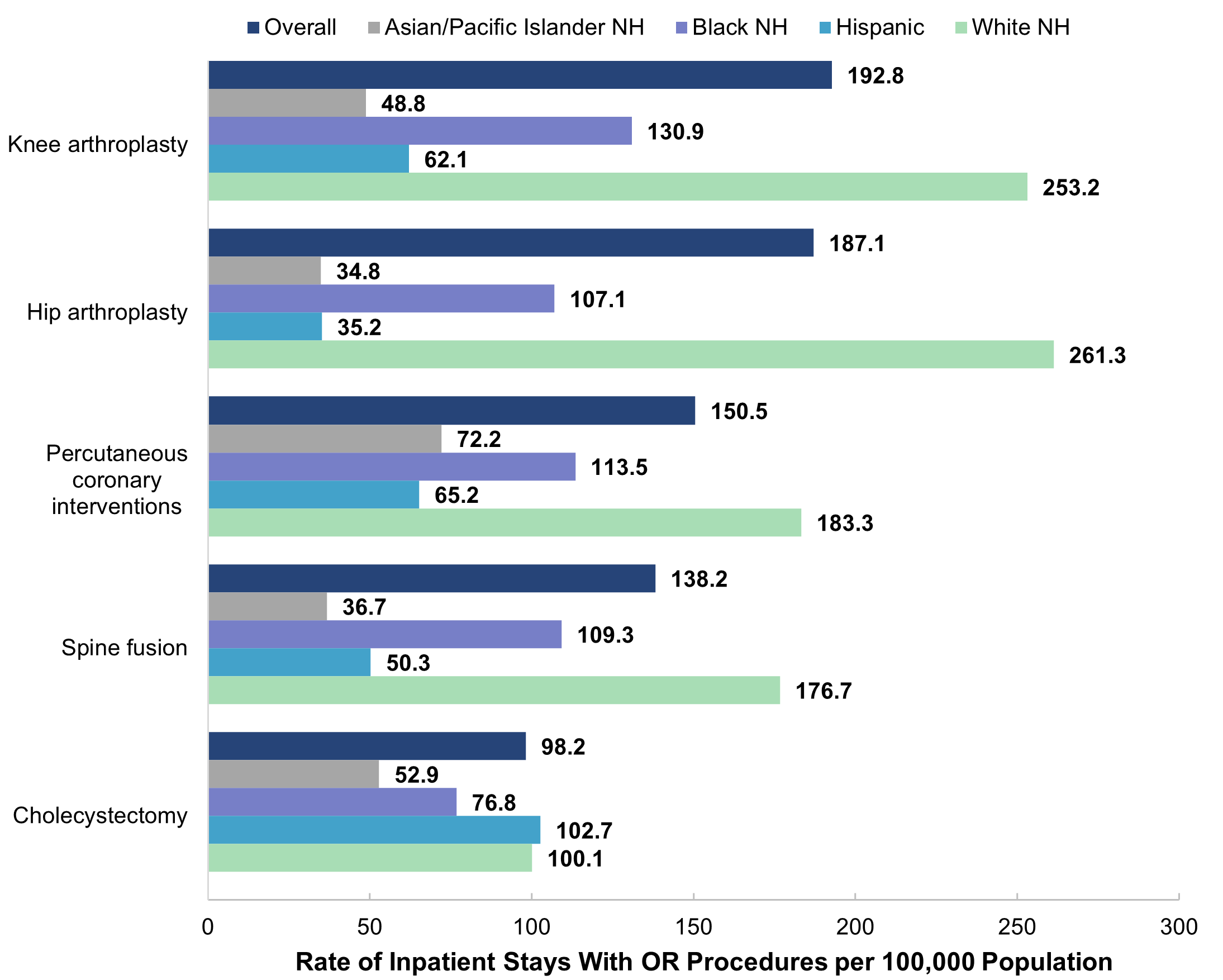 Bar chart showing the rate per 100,000 population of nonmaternal stays with the five most 
					common operating room (OR) procedures by patient race and ethnicity (Asian/Pacific Islander [API] 
					non-Hispanic [NH], Black NH, Hispanic, White NH) in 2019. Knee arthroplasty: overall (192.8), API 
					NH (48.8), Black NH (130.9), Hispanic (62.1), White NH (253.2). Hip arthroplasty: overall (187.1), 
					API NH (34.8), Black NH (107.1), Hispanic (35.2), White NH (261.3). Percutaneous coronary 
					interventions: overall (150.5), API NH (72.2), Black NH (113.5), Hispanic (65.2), White NH (183.3). 
					Spine fusion: overall (138.2), API NH (36.7), Black NH (109.3), Hispanic (50.3), White NH (176.7). 
					Cholecystectomy: overall (98.2), API NH (52.9), Black NH (76.8), Hispanic (102.7), White NH (100.1).